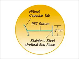 Urolift Suture Anatomy